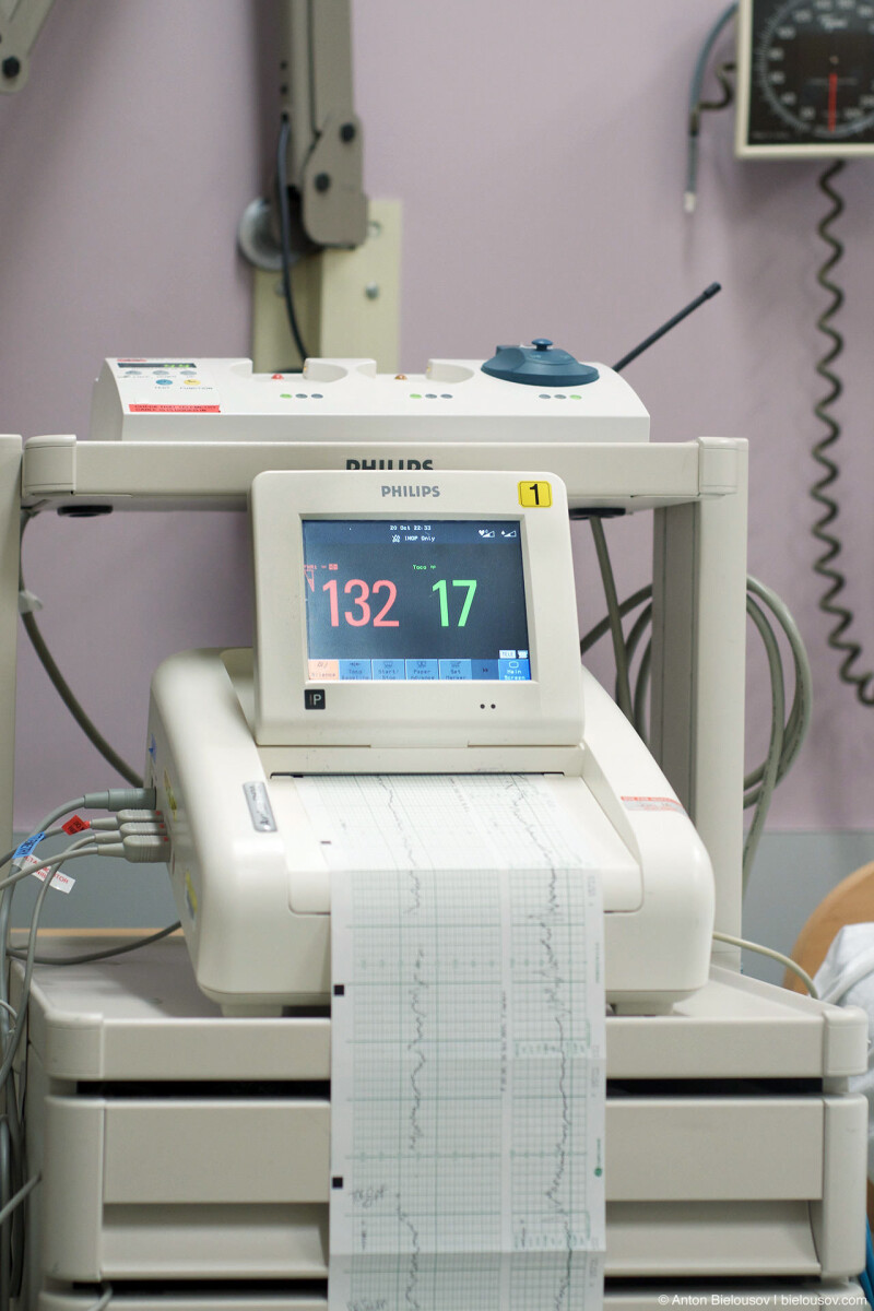 Electronic Fetal Monitor